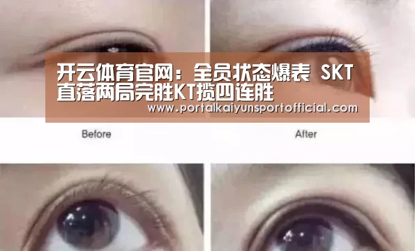 开云体育官网:全员状态爆表 SKT直落两局完胜KT揽四连胜(图2) KAIYUN体育