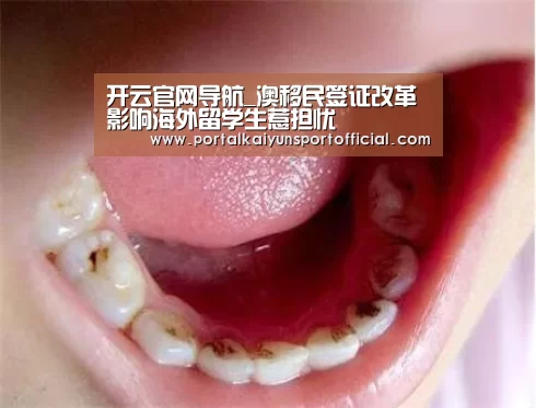 开云官网导航_澳移民签证改革 影响海外留学生惹担忧(图1) 开云官网导航